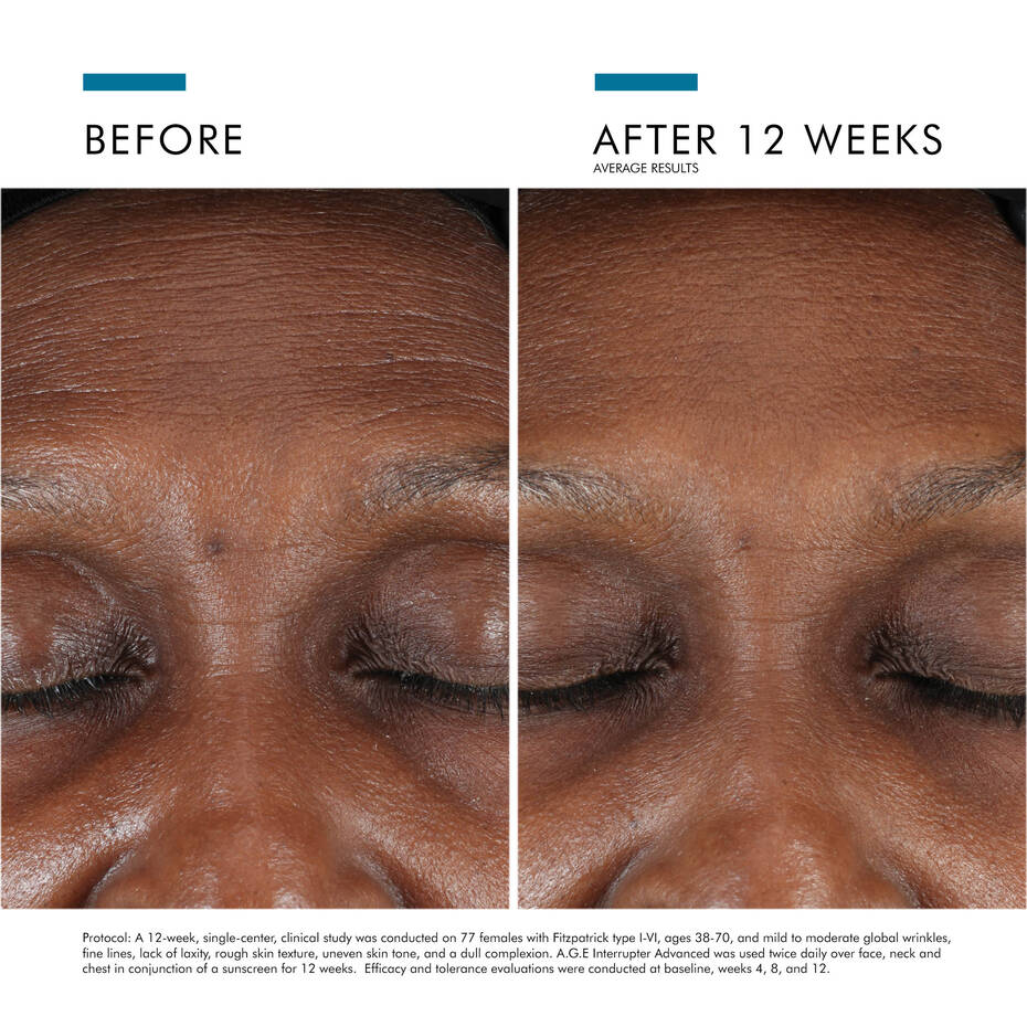 SkinCeuticals A.G.E. Advanced Eye