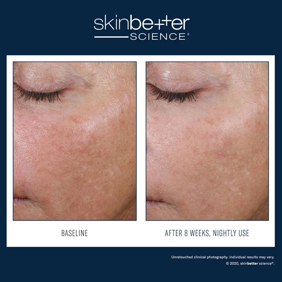 Skin Better Science AlphaRet Overnight Cream