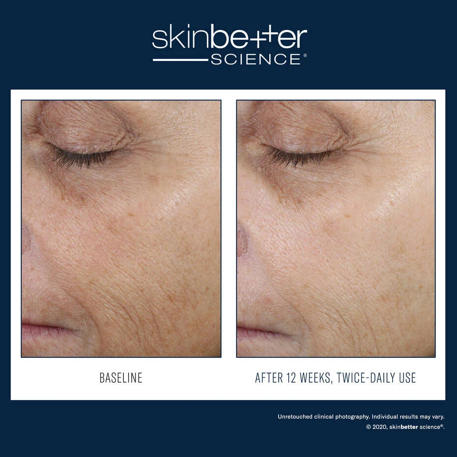 Skin Better Science Even Tone Correcting Serum