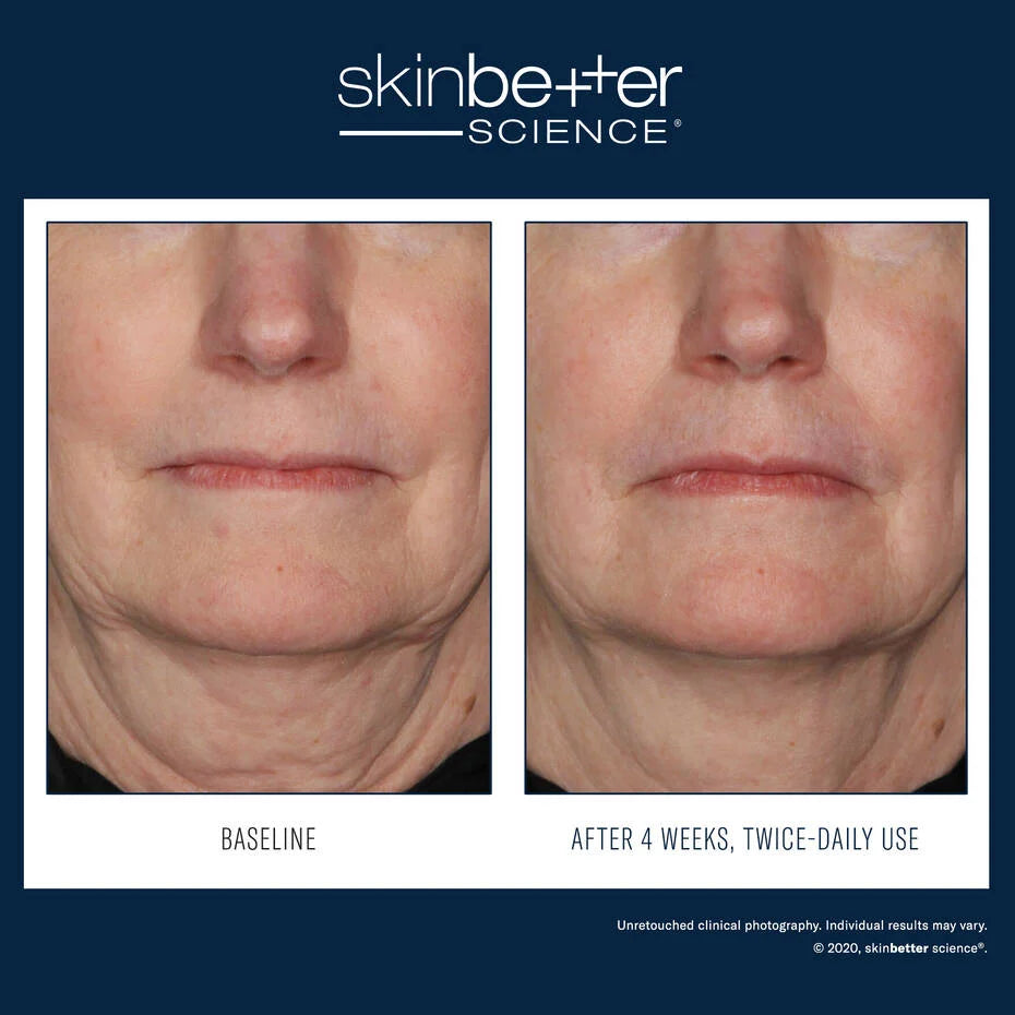 Skin Better Science InterFuse Treatment Cream FACE & NECK