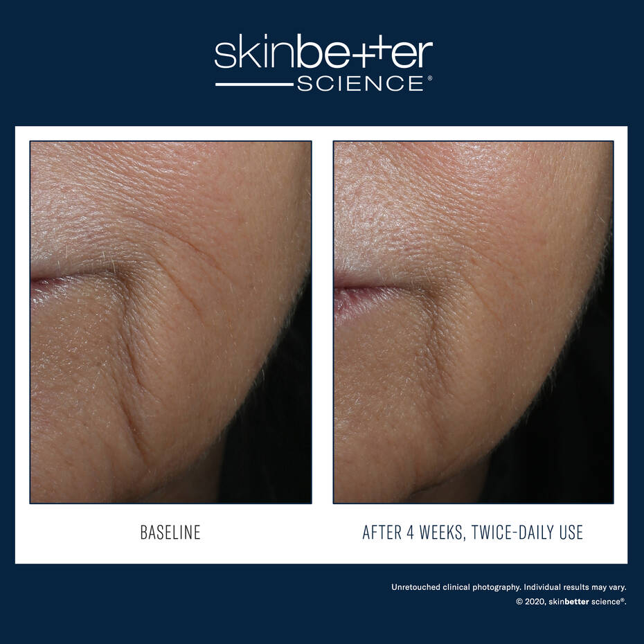 Skin Better Science InterFuse Intensive Treatment LINES