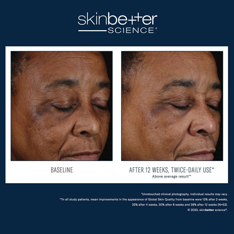 Skin Better Science Mystro Active Balance Serum