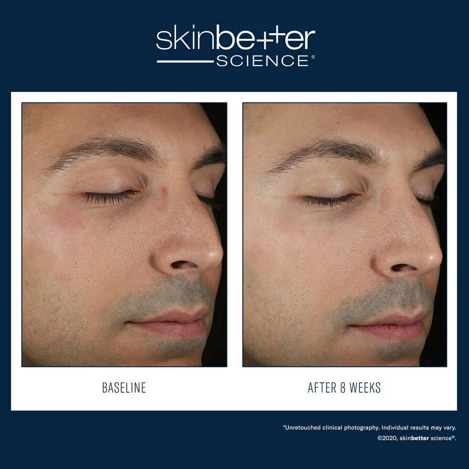 Skin Better Science Solo Hydrating Defense MEN