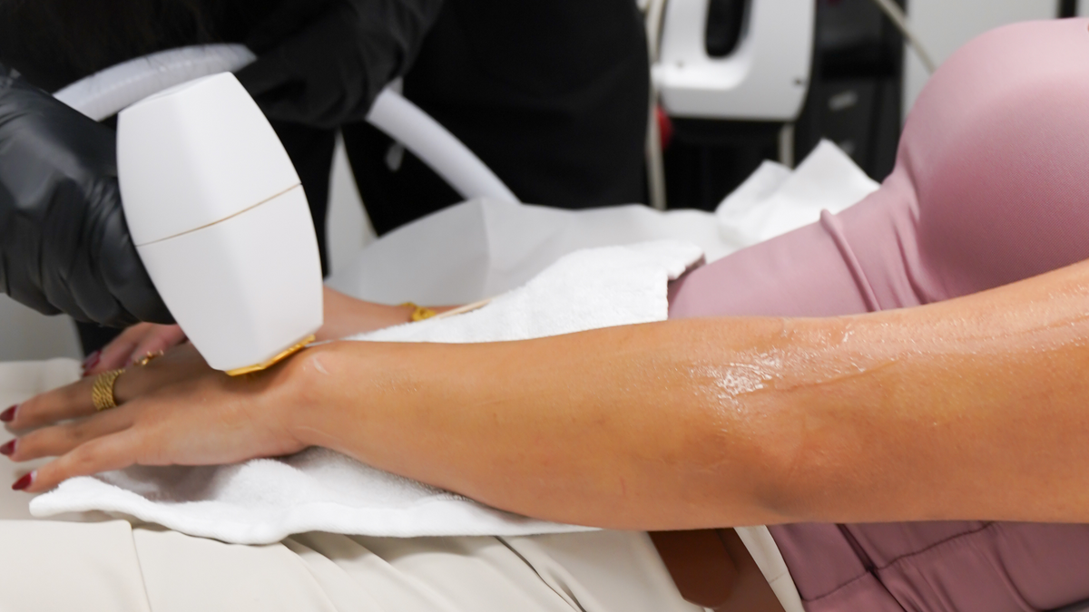 The Long-Term Benefits of Diolaze XL Laser Hair Removal