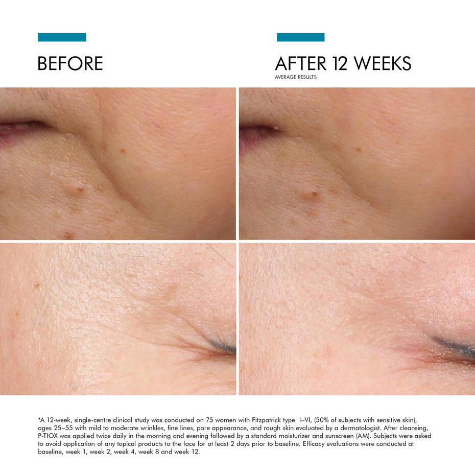 SkinCeuticals P-TIOX
