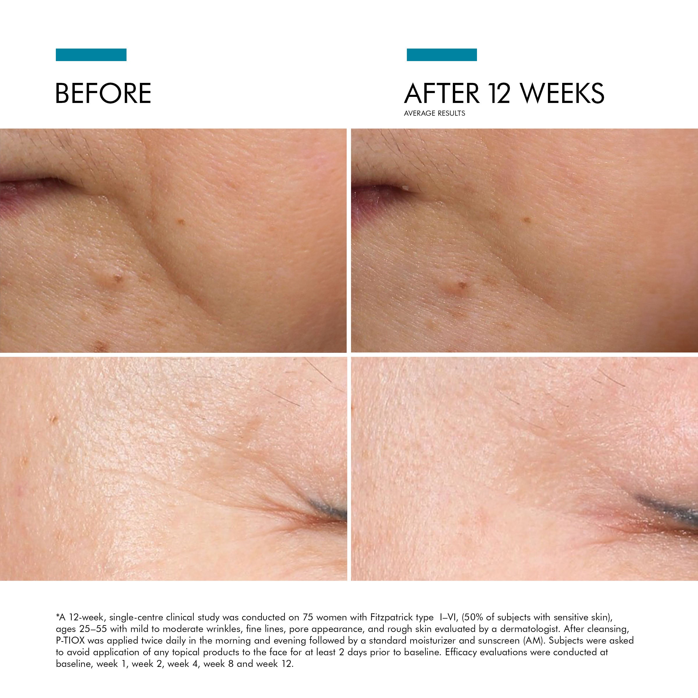 SkinCeuticals P-TIOX Anti-Wrinkle Serum